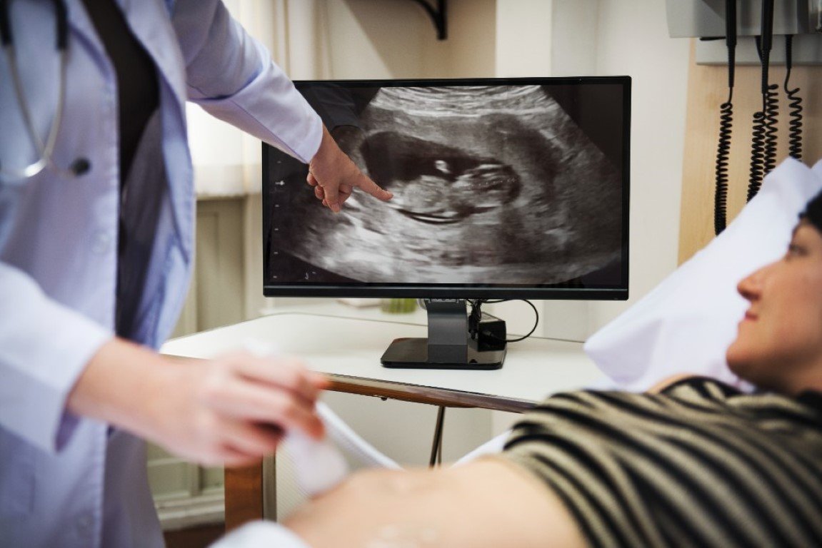 Sonography